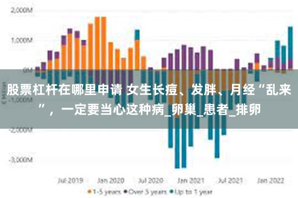 股票杠杆在哪里申请 女生长痘、发胖、月经“乱来”，一定要当心这种病_卵巢_患者_排卵